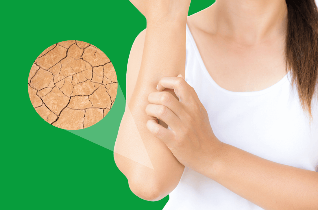 The Link Between Dry Skin and Your Gut